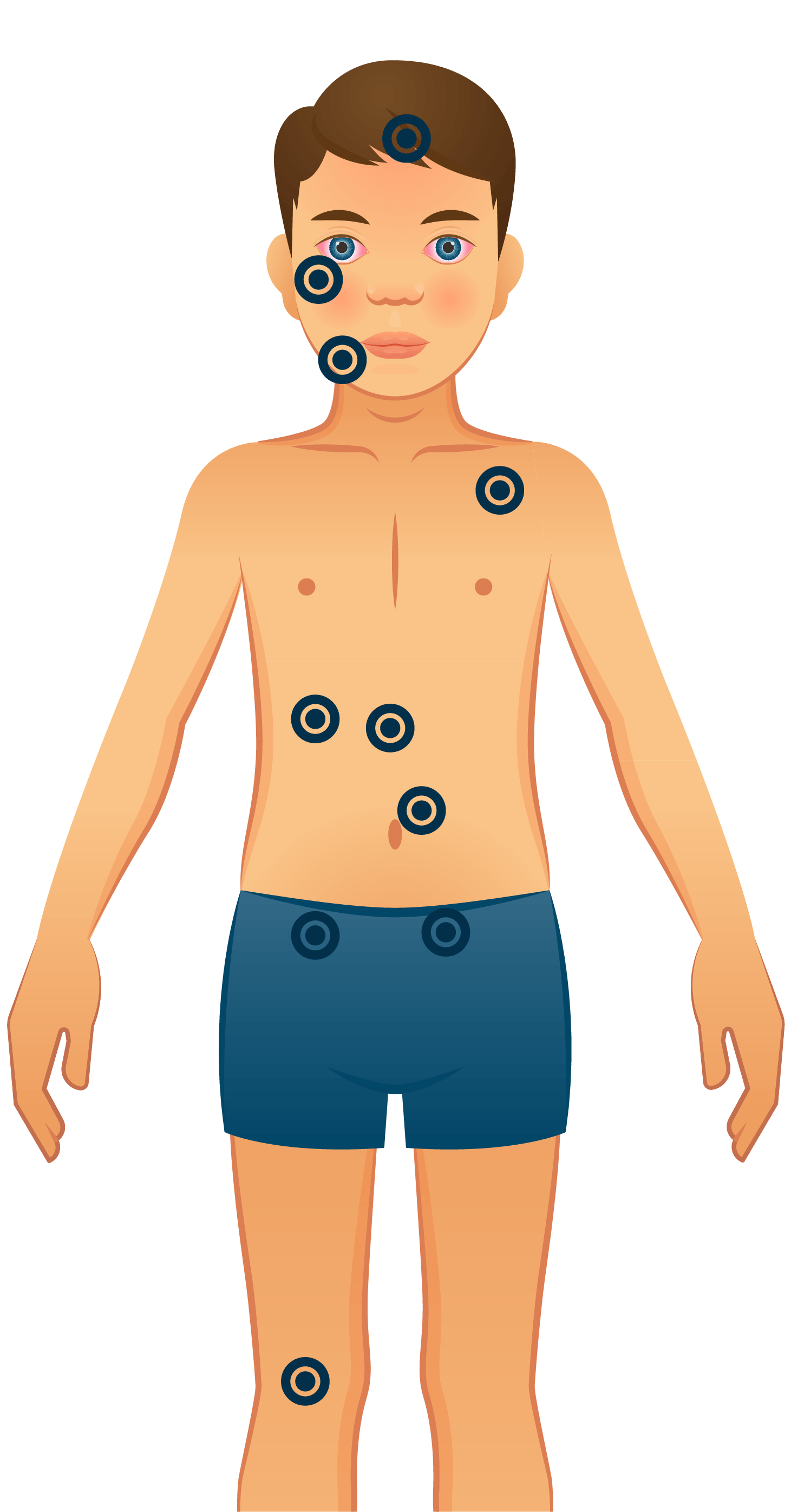 Illustration of a person with dots indicating symptoms on various parts of the body